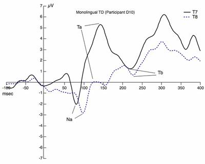 Language Learning Under Varied Conditions: Neural Indices of Speech Perception in Bilingual Turkish-German Children and in Monolingual Children With Developmental Language Disorder (DLD)